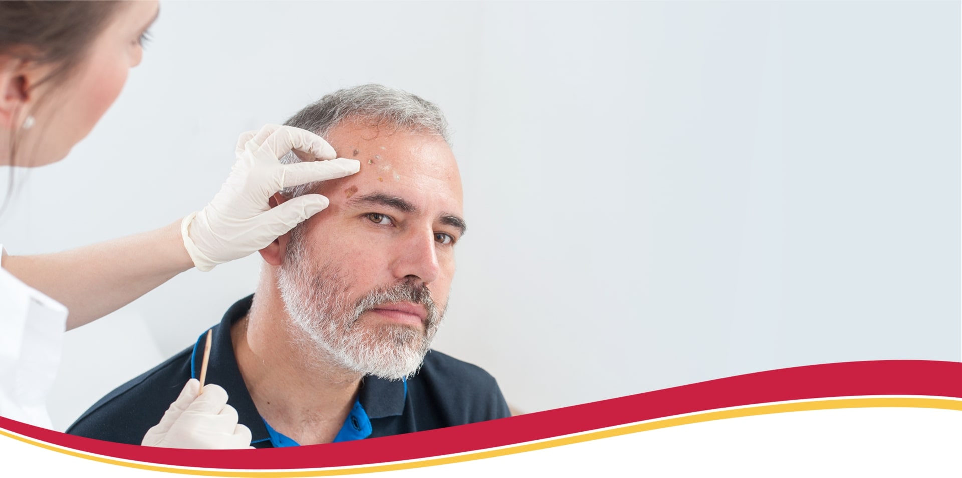 Female phyisician examining lesions on a man's forehead using with her gloved hands