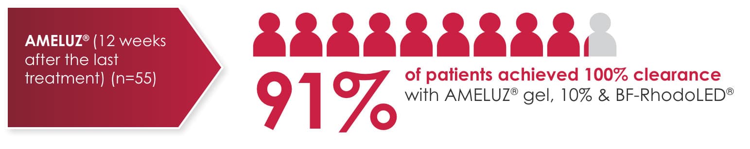 Infographic showing 91% of patients achieved 100% clearance 12 weeks after the last treatment with AMELUZ® gel and BF-RhodoLED® (n=55), represented by 10 red icons, 9 filled and 1 unfilled.
