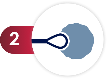 Pictogram of a curette tip and a lesion.